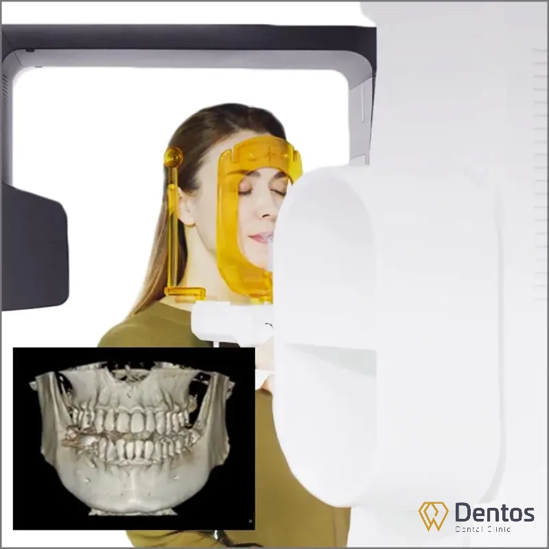 Phim CT 3D giúp khảo sát chi tiết cấu trúc xương hàm, vị trí dây thần kinh